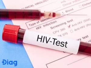 Xét nghiệm HIV sau 2-3 tháng là chính xác nhất.