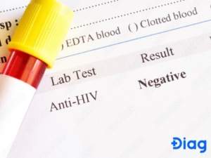 Kết quả xét nghiệm HIV có thể âm tính giả